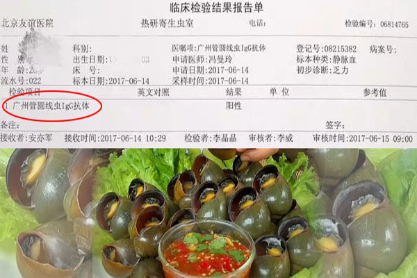 从流产到脑感染：起底福寿螺杀人事件背后的食安黑洞